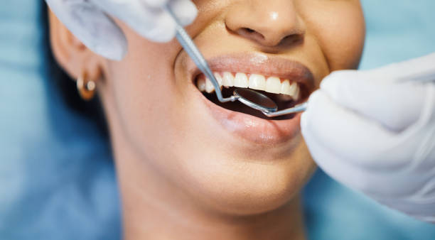 Best Emergency Tooth Extraction  in Versailles, OH