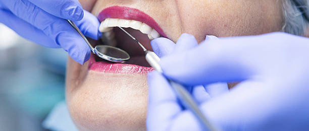 Best Chipped Tooth Repair Near Me  in Versailles, OH